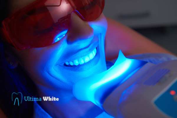 Professional Teeth Whitening Options Lowestoft