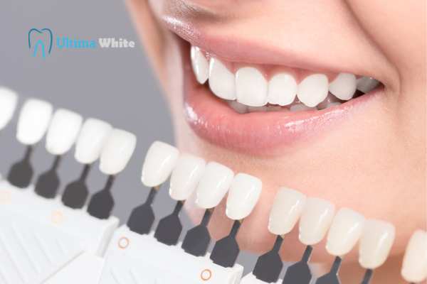 How to Maximise the Results of Your Laser Teeth Whitening Treatment Lowestoft