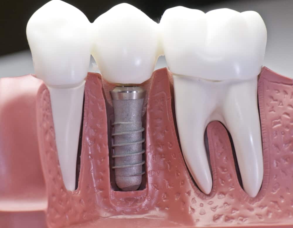 Common Misconceptions About Modern Dental Treatments Lowestoft