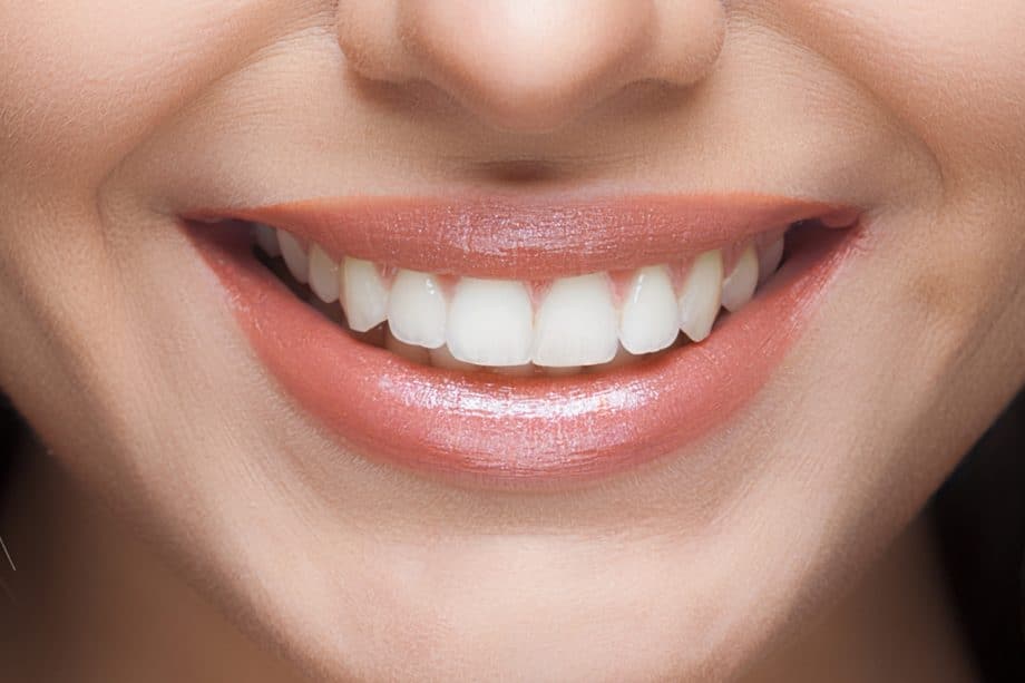 The Role of a Balanced Diet in Long-Term Whitening Results Lowestoft