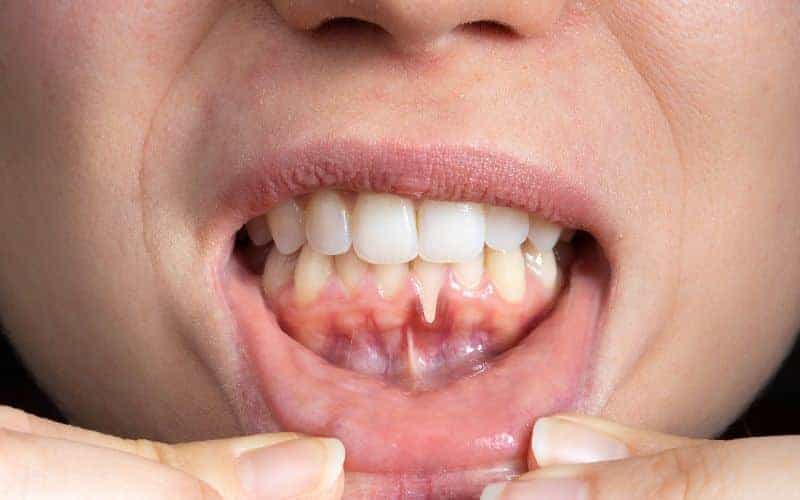 Final Thoughts: Building Lifelong Enamel Protection Habits Lowestoft