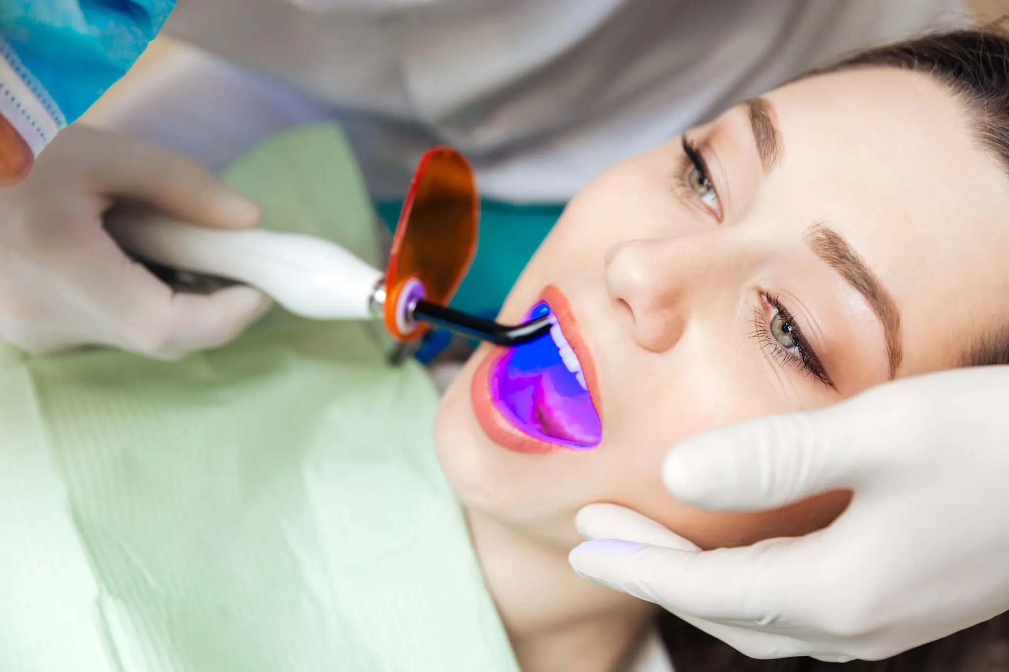 How Fast Can You See Results with Laser Teeth Whitening Lowestoft?