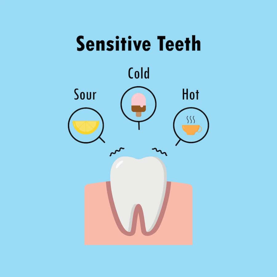 Why Do Teeth Become Sensitive After Whitening Treatments Lowestoft?