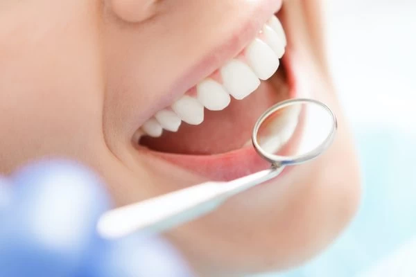 Preventing White Spots on Teeth Lowestoft