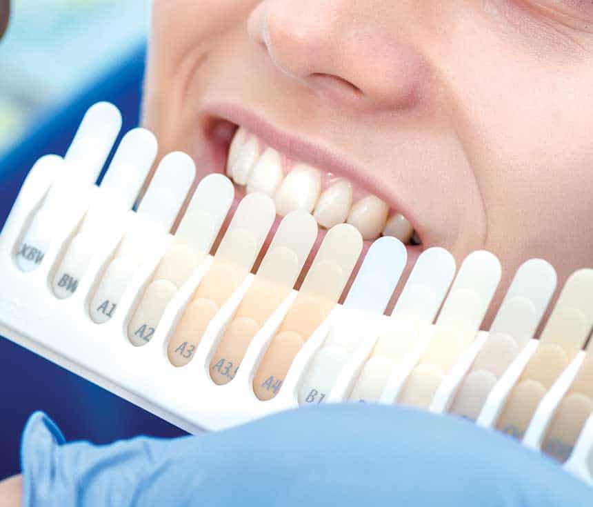 Is Laser Teeth Whitening Worth It for a Brighter, Confident Smile Lowestoft?