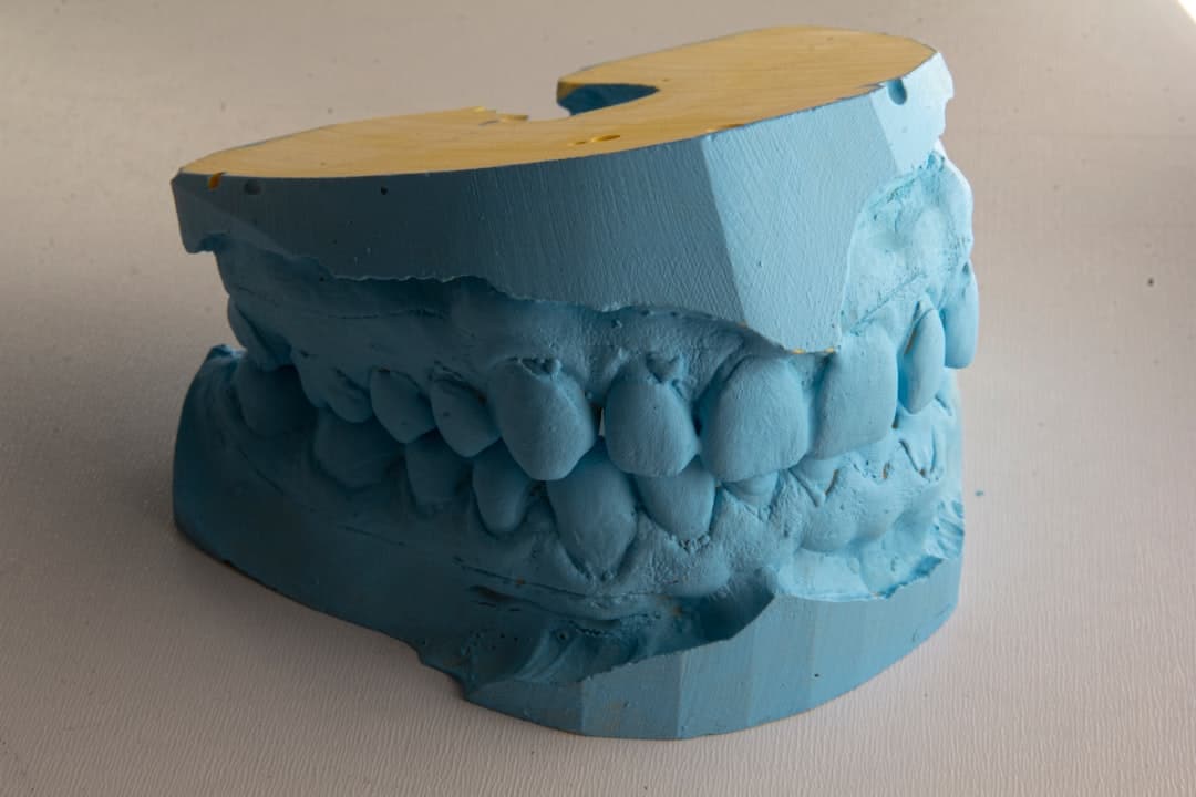 How Do Dental Implants Improve Jawbone Health and Oral Function Lowestoft?