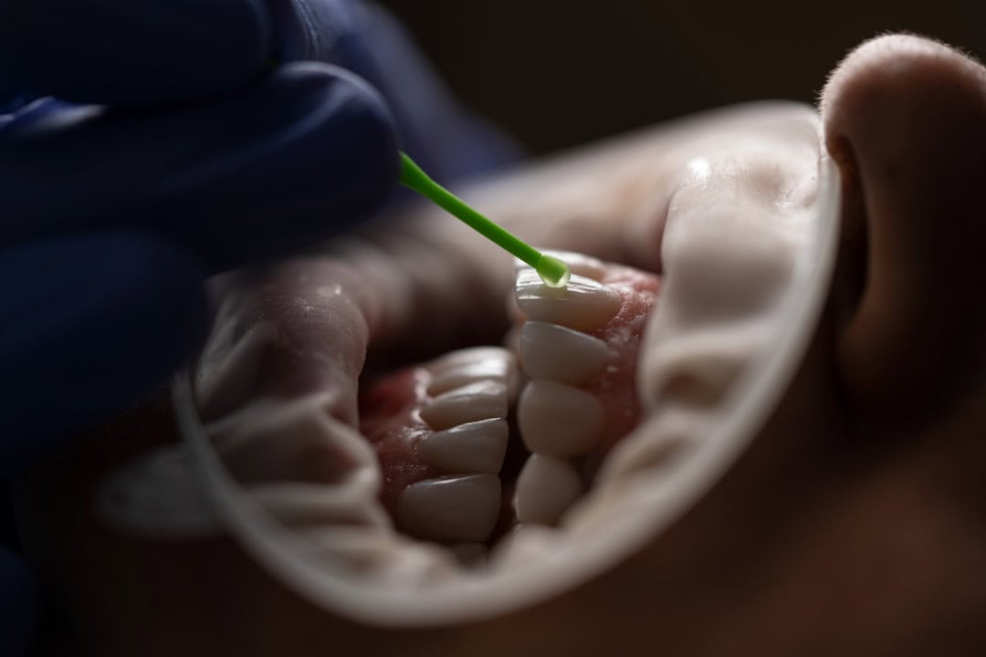 How Saliva Protects Your Teeth and Gums Lowestoft