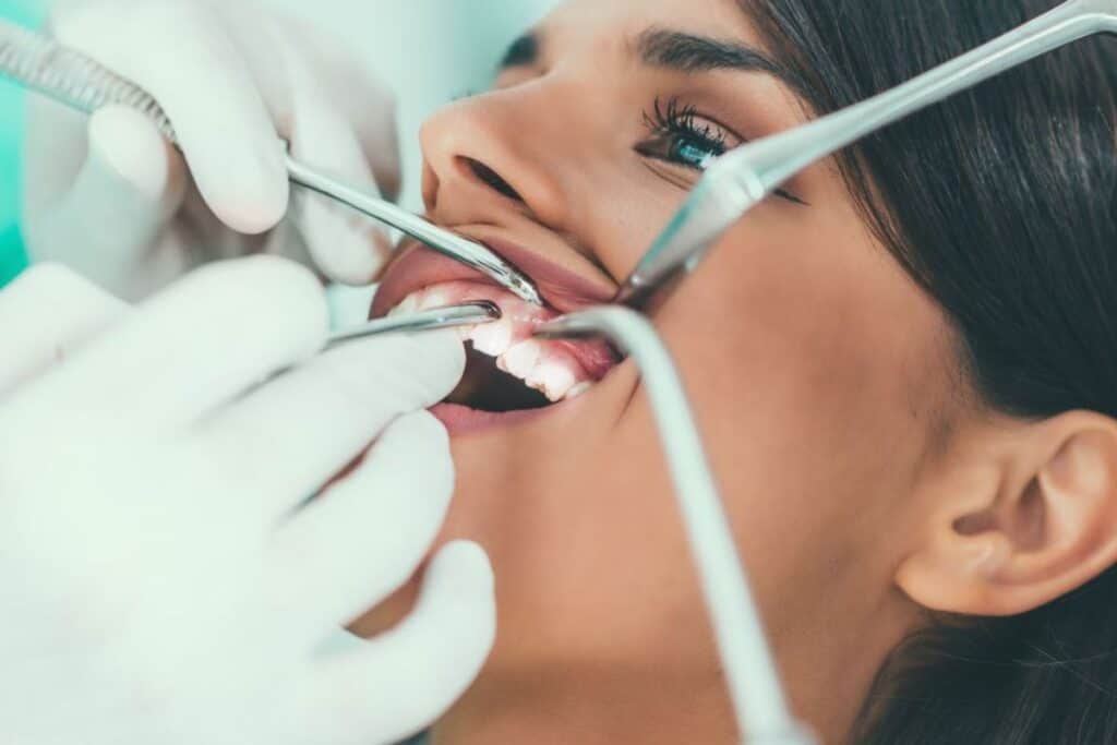 Braces Are Just for Kids – Myth or Reality Lowestoft