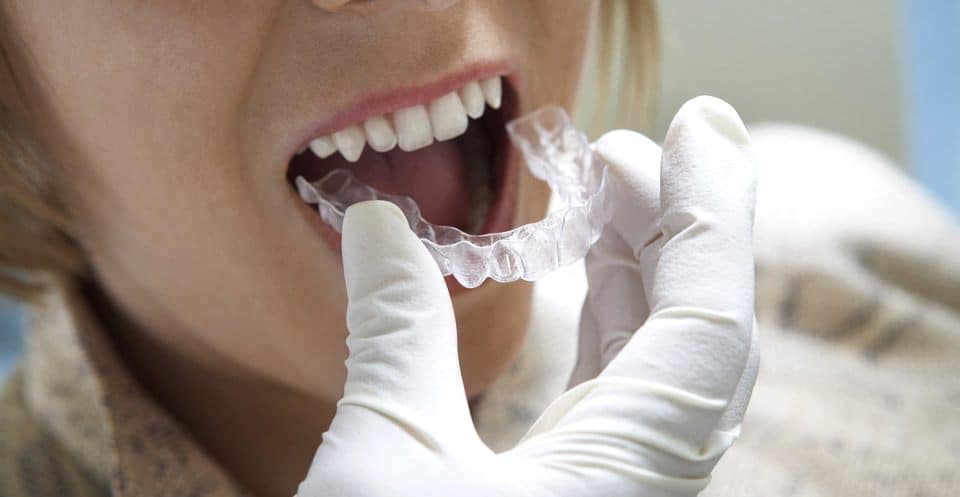 Can Bruxism Affect Your Sleep Quality Lowestoft