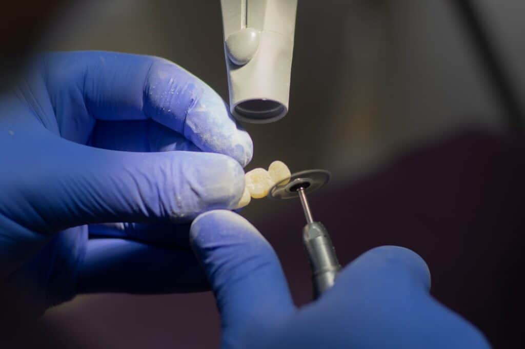 Customised Dental Solutions: Crowns, Aligners, and Implants Lowestoft