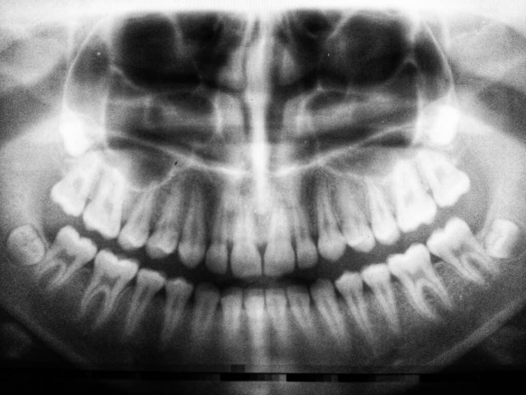 The Future of 3D Printing in Oral Healthcare Lowestoft